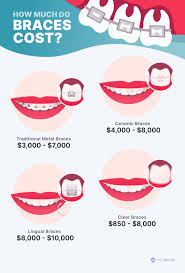 5 Types of Braces (Procedures, Costs & FAQs) - NewMouth - bracket metal