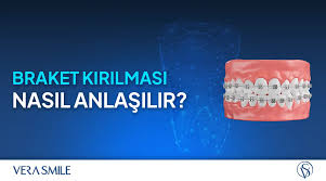 Braket Nedir? Braket Kırılması Nasıl Anlaşılır? - metal braket